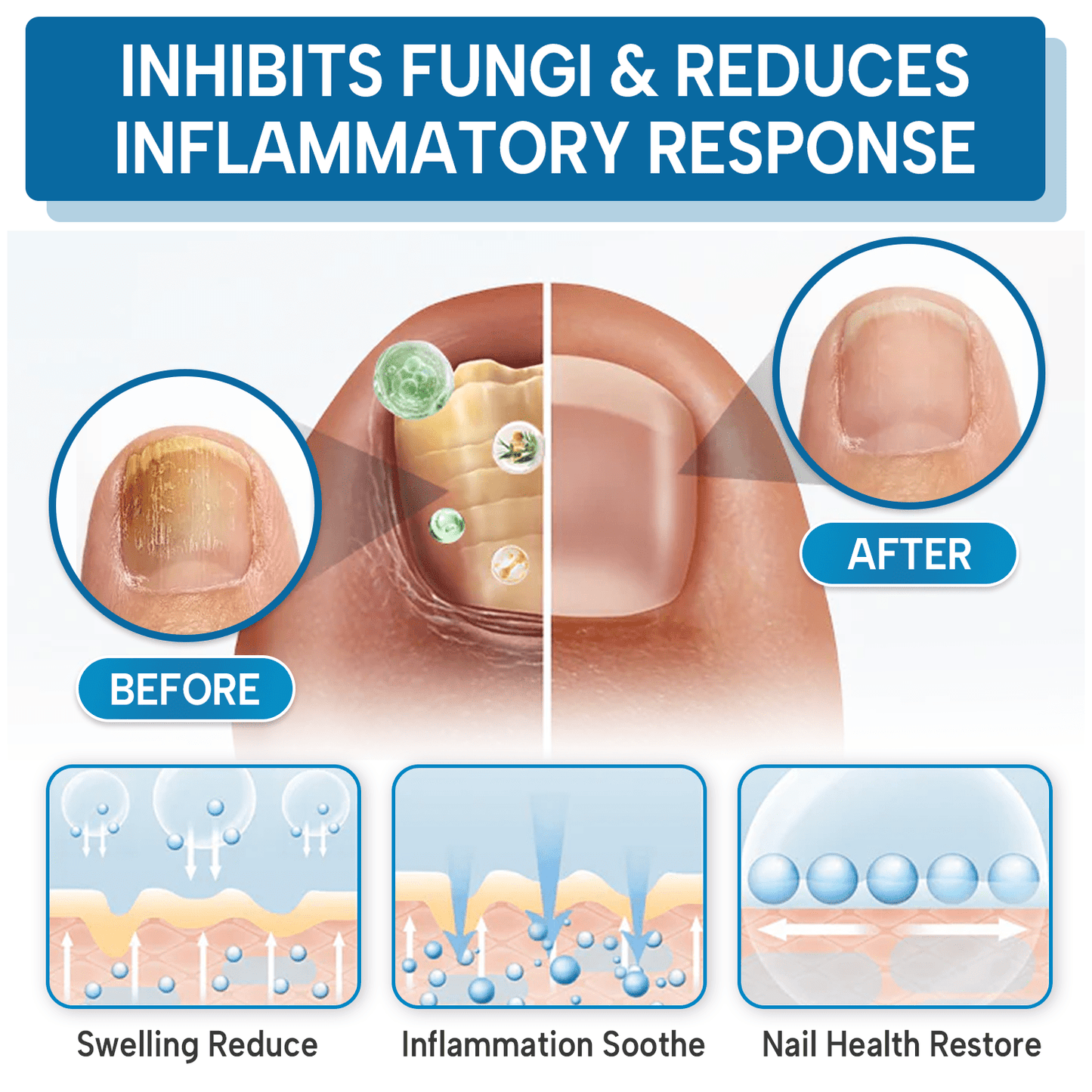 Lbmlbm® OnyxiGuard Fungal Repair Herbal Spray – 🌿 Natural Treatment for Healthy, Revitalized Skin & Nails ✨