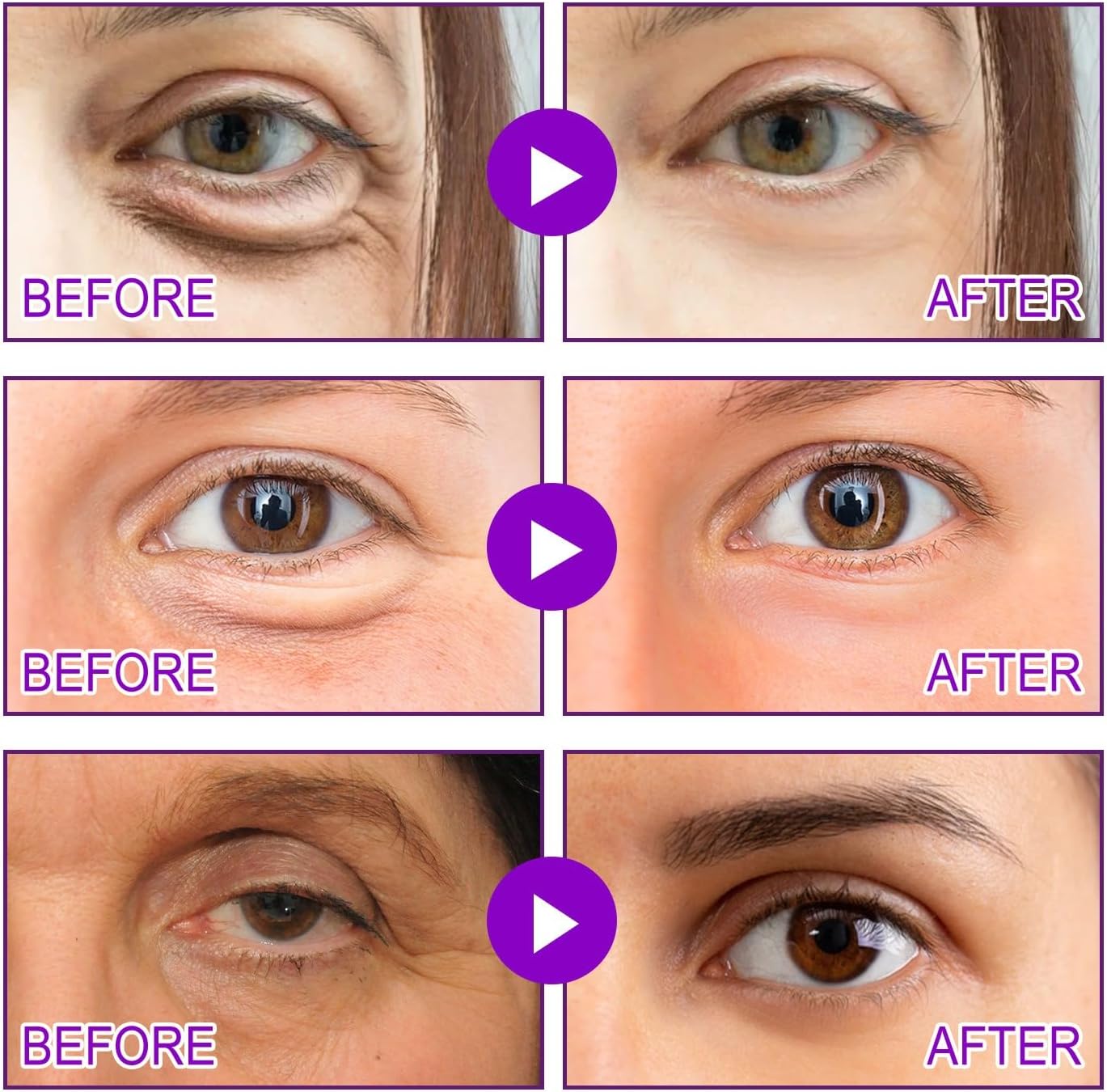 Seurico™ MicroGlow Patches