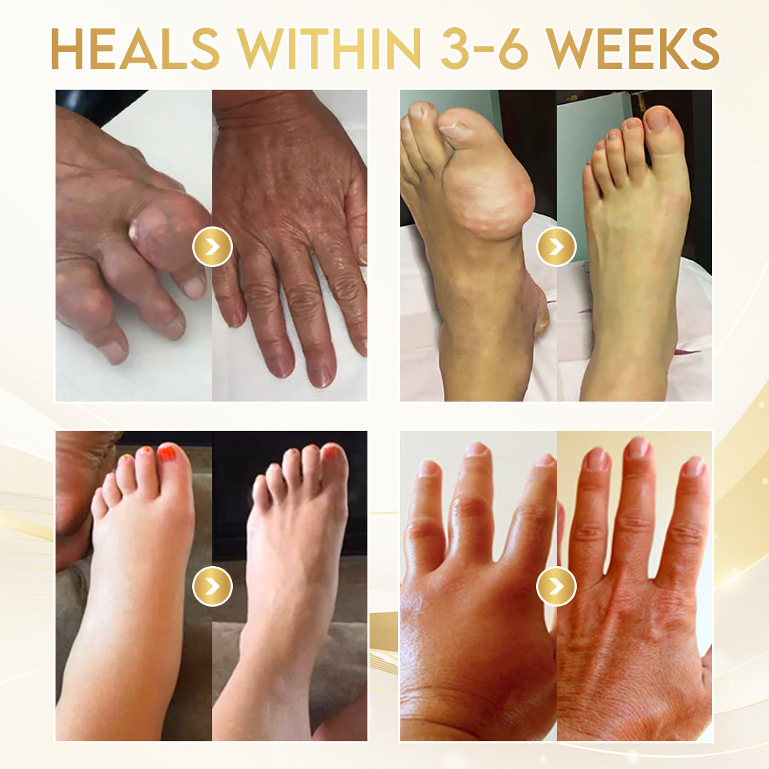 Odeiun™ Orthopedic Cream | AAOS-Inspired Pain Relief & Bone Support with Bee Venom + Botulinum