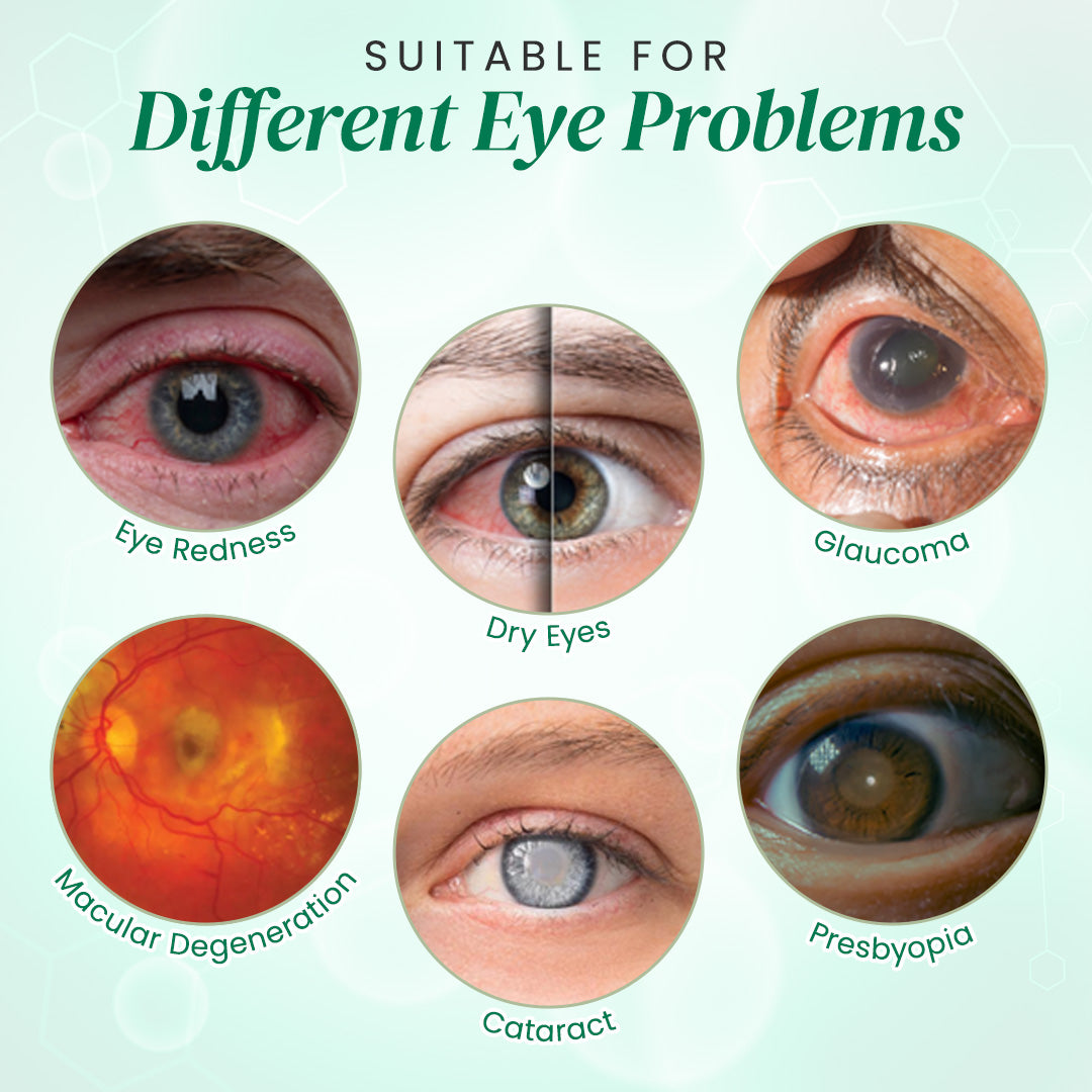 👩⚕️Seurico™ Nano Eye Drops Serum ✅Approved by the American Academy of Ophthalmology(Suitable for presbyopia, dry eye syndrome, glaucoma, and cataracts