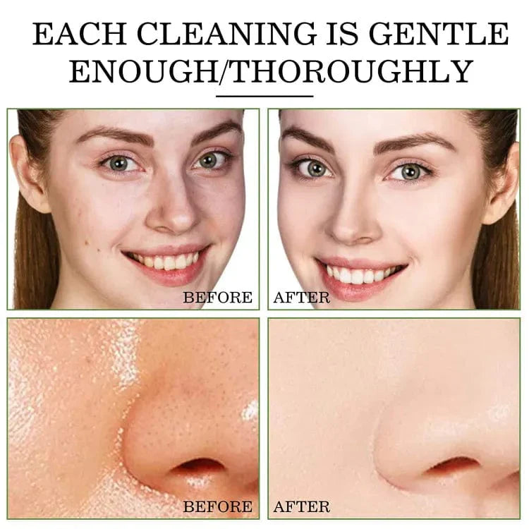 Zakdavi™ Detoxifying Green Tea Face Mask Stick