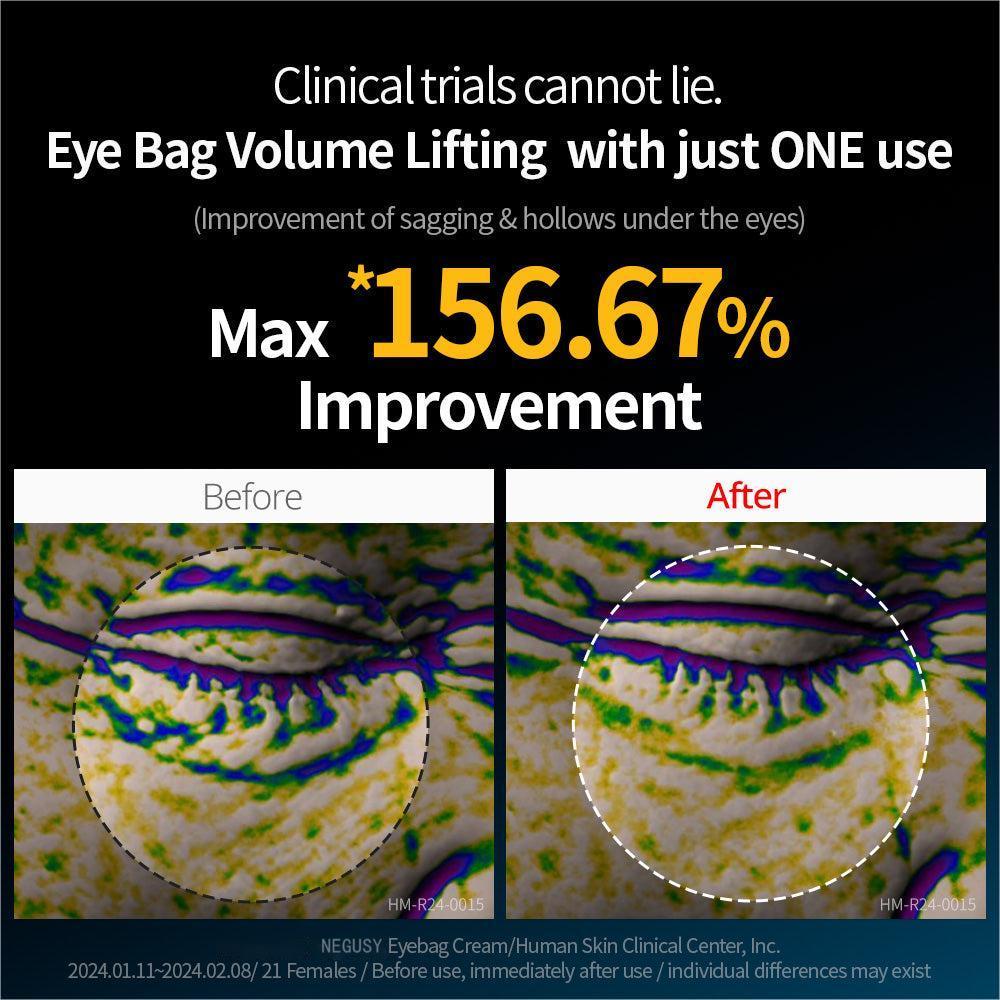 Seurico 60-SECOND EYE FIRMING GEL🕙