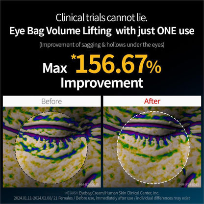 Seurico 60-SECOND EYE FIRMING GEL🕙