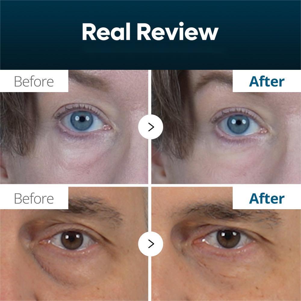 Seurico 60-SECOND EYE FIRMING GEL🕙