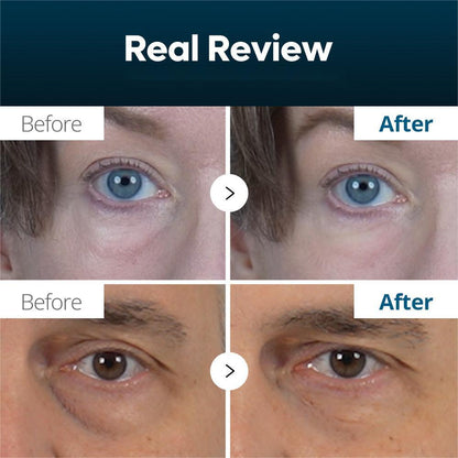 Seurico 60-SECOND EYE FIRMING GEL🕙