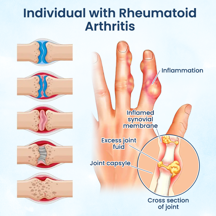 Negusy™ Joint Revive Hyaluronic Repair Cream