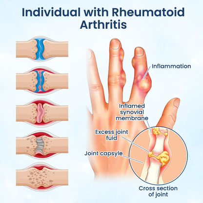 Negusy™ Joint Revive Hyaluronic Repair Cream
