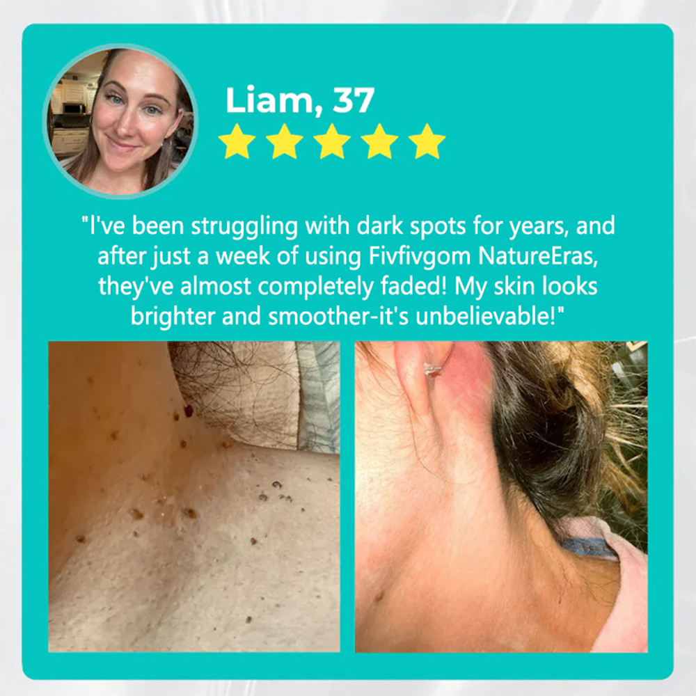 ODALIT™ NatureErase Instant Mole & Spot Removal Gel