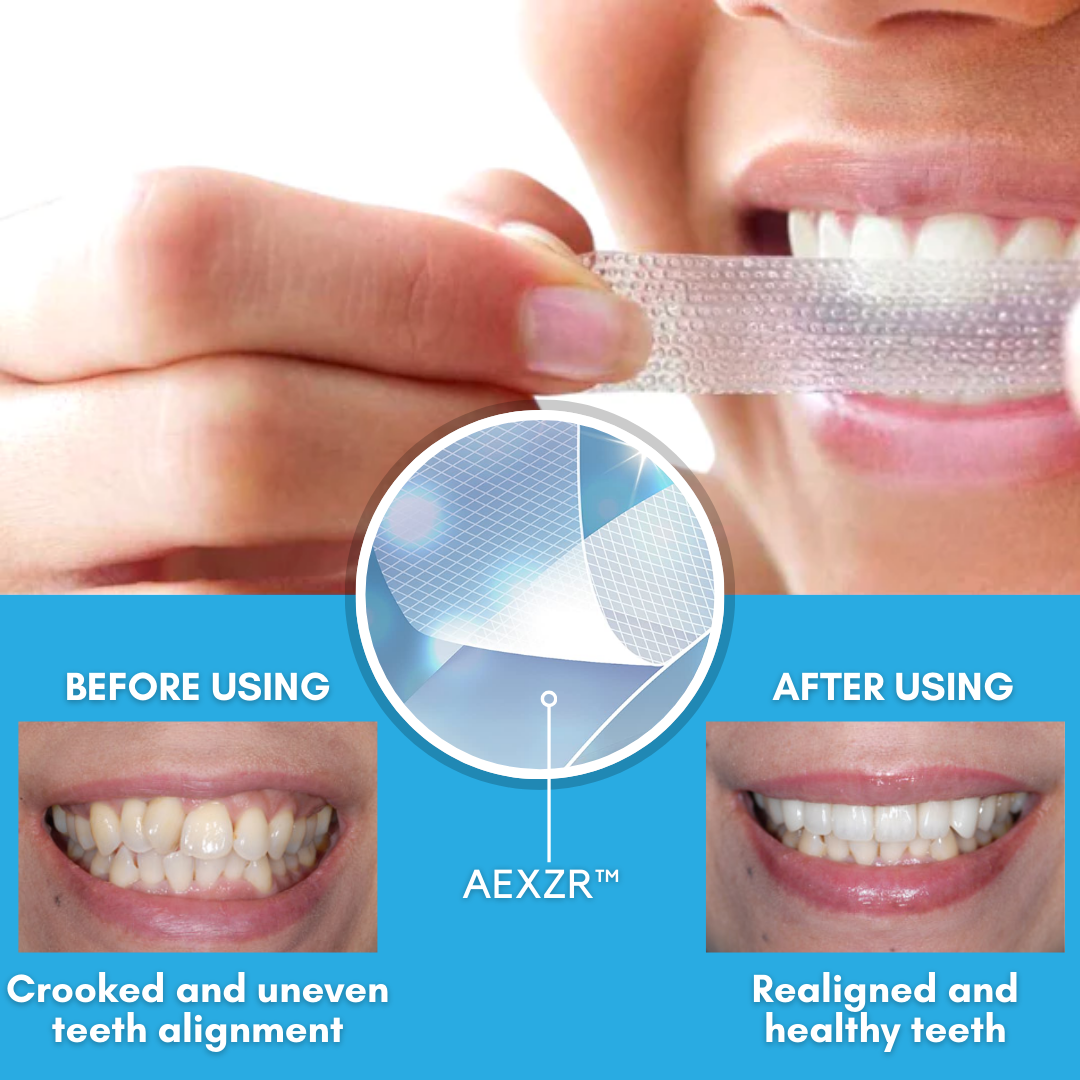 Zakdavi™ Whitening & Aligning Strips – Achieve a Perfect Smile in Less Than a Month, No Braces Needed!