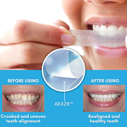 Zakdavi™ Whitening & Aligning Strips – Achieve a Perfect Smile in Less Than a Month, No Braces Needed!