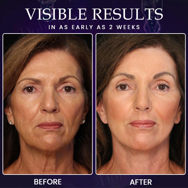 Negusy™ Firming Cream – Instantly Smooth Wrinkles & Fine Lines, Restore Youthful Radiance!