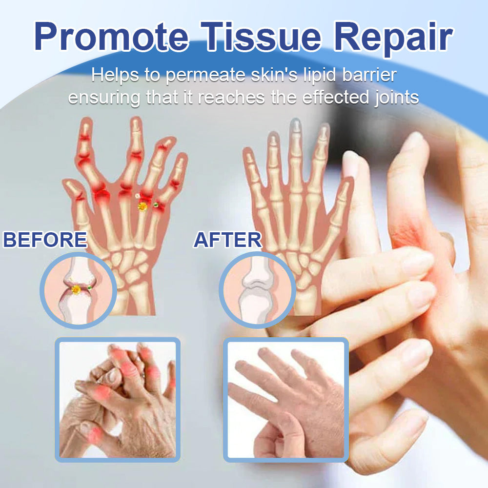 ✅HSE Approved: Seurico™ Magnesium Pain Healing Bone Cream ( Relief of neuropathy, muscle spasms, chronic pain, twitches or cramps, poor bone health and other arthritis)