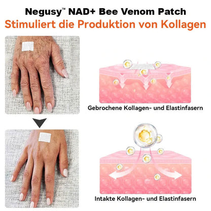 [7 Days to See Results] Negusy™ NAD+ Bee Venom Skin Patch – Ultimate Skin Rejuvenation & Energy Boost（Last Day Discount：70%）