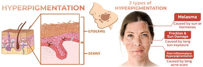 Seurico™ Melanin Correcting Facial Serum