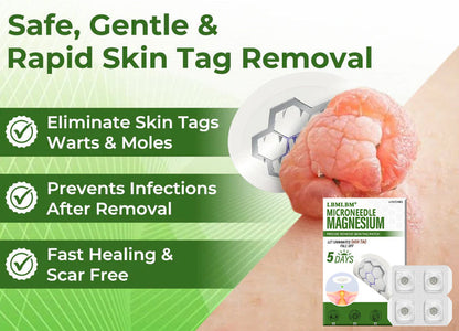 🔥Final 3 Hours: 80% OFF - LBMLBM® Magnesium MicroNeedle Precise Remove Skin Tag Patches