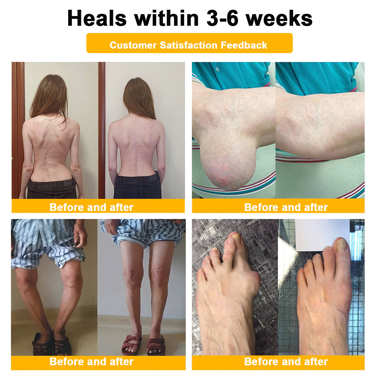 🎁Flash Sale - Odeiun™ Botulinum Toxin & Bee Venom Pain-Relief Bone Healing Cream