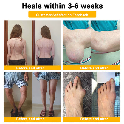 🎁Flash Sale - Odeiun™ Botulinum Toxin & Bee Venom Pain-Relief Bone Healing Cream