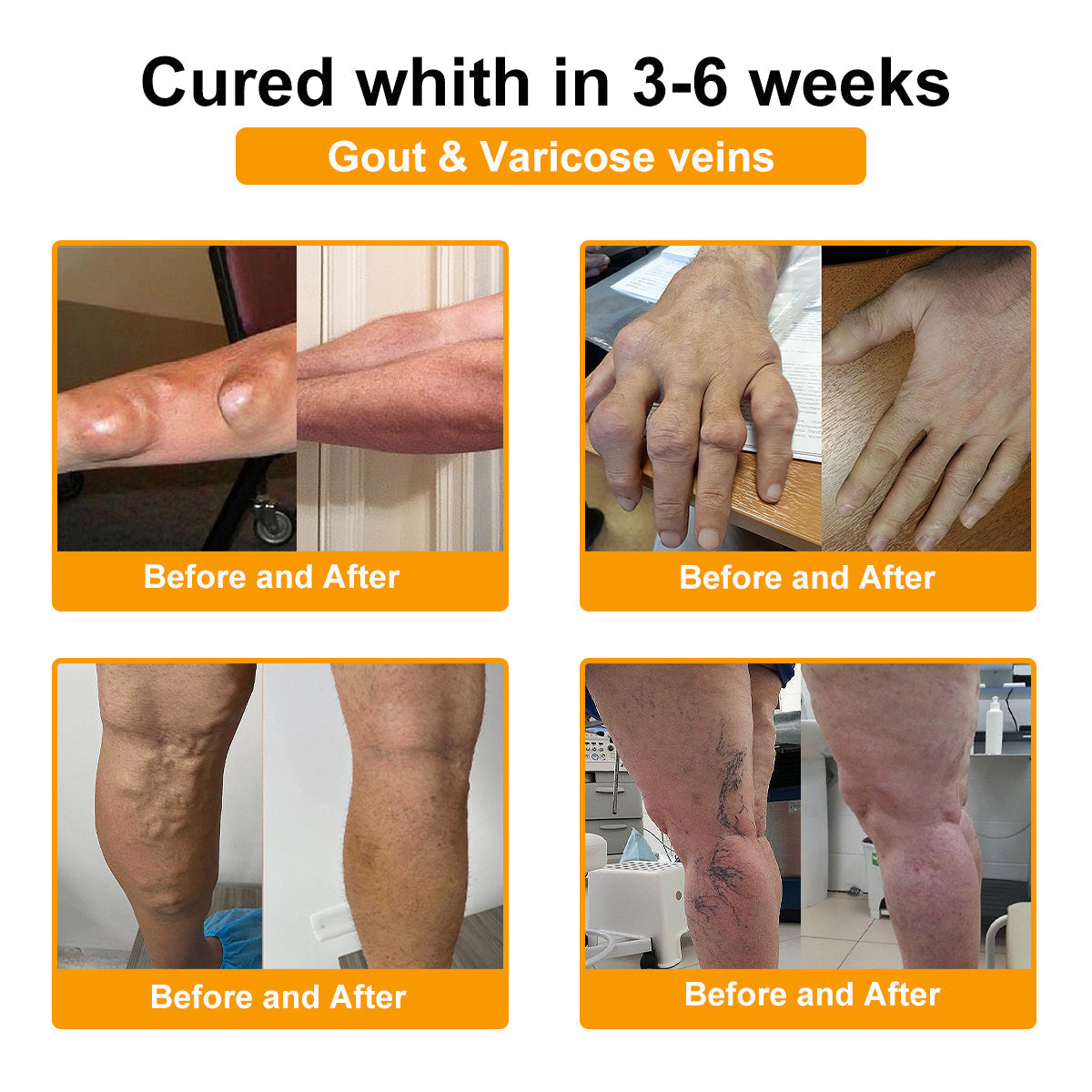 🎁Flash Sale - Odeiun™ Botulinum Toxin & Bee Venom Pain-Relief Bone Healing Cream