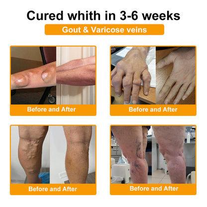 🎁Flash Sale - Odeiun™ Botulinum Toxin & Bee Venom Pain-Relief Bone Healing Cream