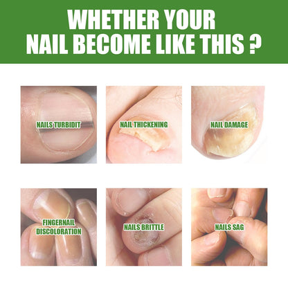 🔥Seurico™ Fungal Inhibiting Stick |Say Goodbye to Nail Fungus in Just 5 Days!