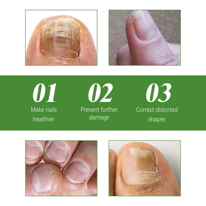 🔥Seurico™ Fungal Inhibiting Stick |Say Goodbye to Nail Fungus in Just 5 Days!