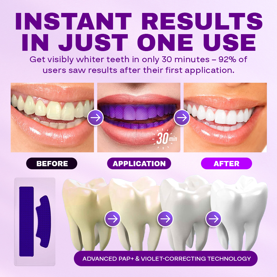 NEGUSY™ Purple Whitening Teeth Strips