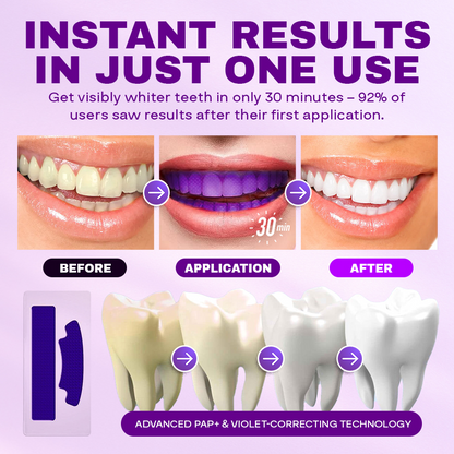 NEGUSY™ Purple Whitening Teeth Strips