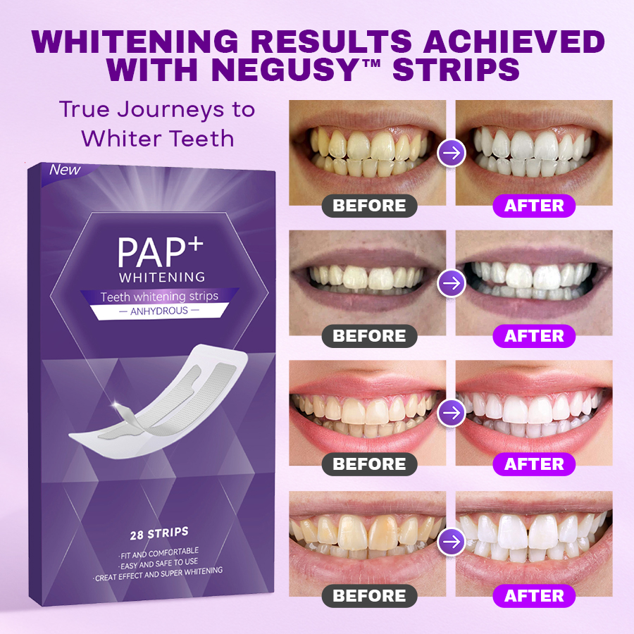 NEGUSY™ Purple Whitening Teeth Strips