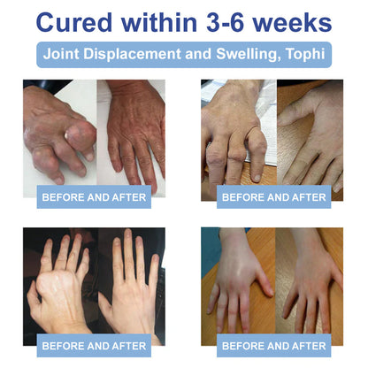 ✅HSE Approved: Seurico™ Magnesium Pain Healing Bone Cream ( Relief of neuropathy, muscle spasms, chronic pain, twitches or cramps, poor bone health and other arthritis)