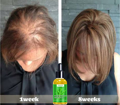 ODALIT™ Hair Growth Serum 🌱(AAD recommended)