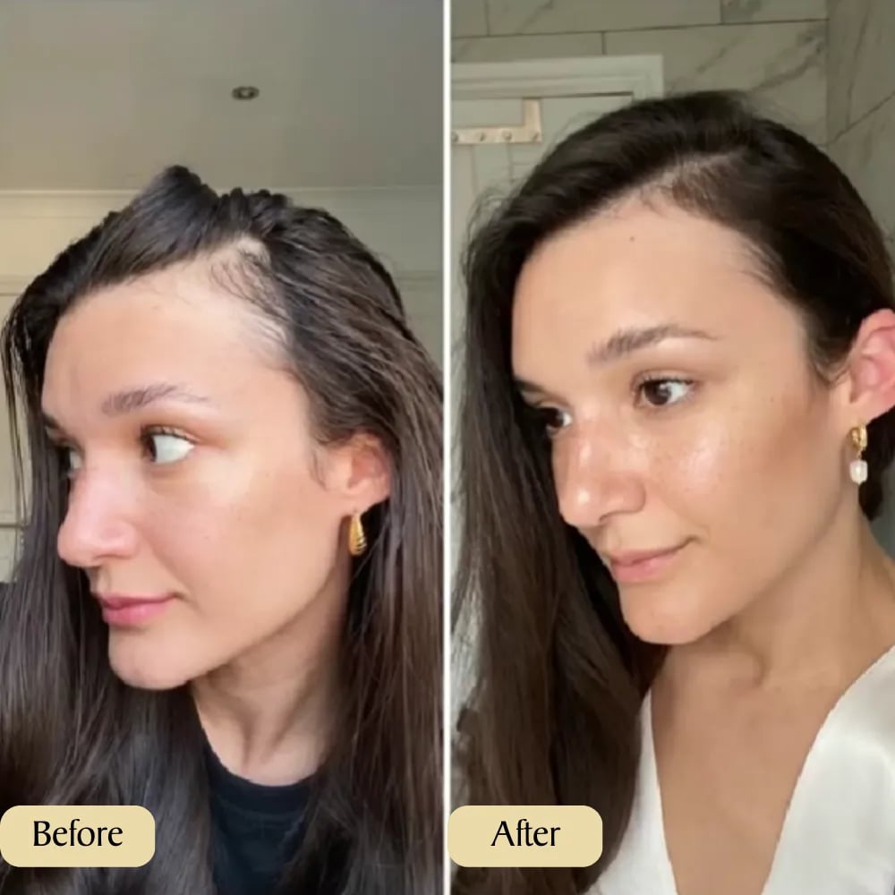 🌟 Last Day Sale – 80% OFF! 🌟Seurico™ Rosemary Hair Growth Oil 100% Natural Hair Growths