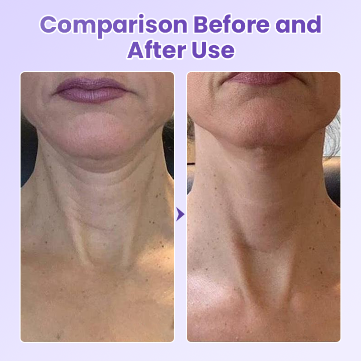 Negusy™ NeckYouth Peptide Anti-Wrinkle Patch