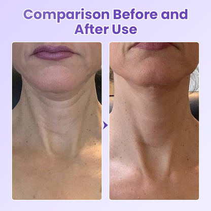 Negusy™ NeckYouth Peptide Anti-Wrinkle Patch