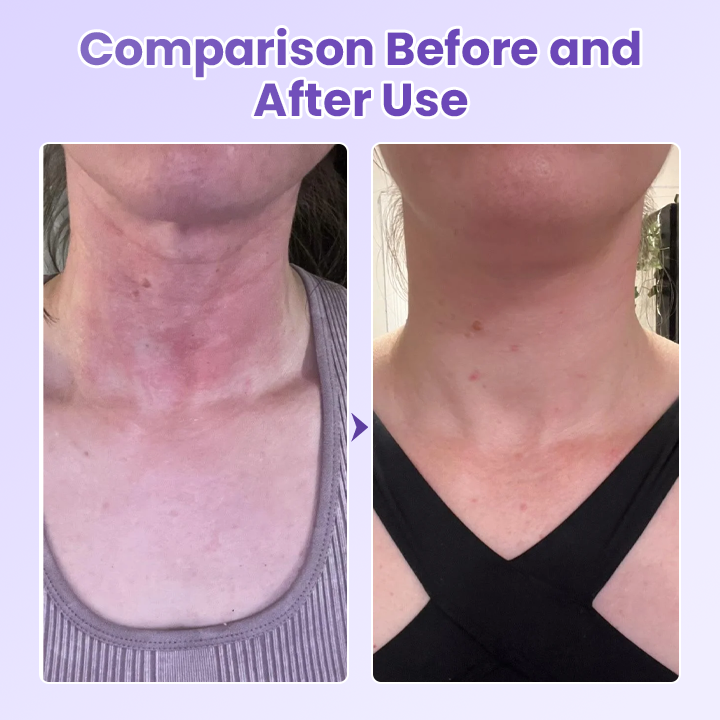 Negusy™ NeckYouth Peptide Anti-Wrinkle Patch