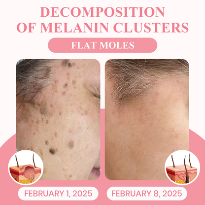 Negusy™ Dual Acid Wart & Mole Removal Serum