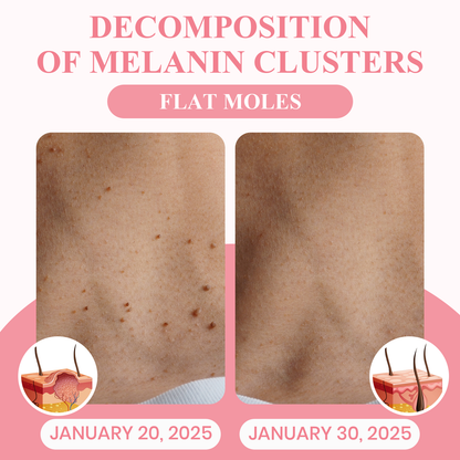 Negusy™ Dual Acid Wart & Mole Removal Serum