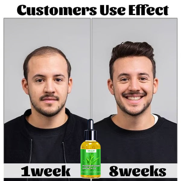 ODALIT™ Hair Growth Serum 🌱(AAD recommended)