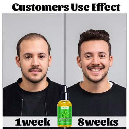 ODALIT™ Hair Growth Serum 🌱(AAD recommended)