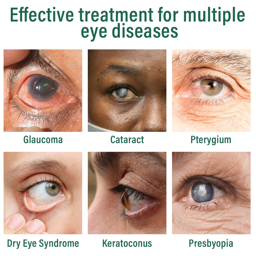 👩‍⚕️Seurico™ Nano Eye Drops Serum ✅FDA Approved(Suitable for presbyopia, dry eye syndrome, glaucoma, and cataracts) 🌻