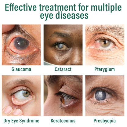 👩‍⚕️Seurico™ Nano Eye Drops Serum ✅FDA Approved(Suitable for presbyopia, dry eye syndrome, glaucoma, and cataracts) 🌻