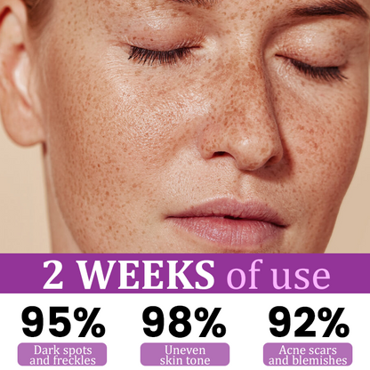 Seurico™ MelantraY Anti-Hyperpigmentation Essence