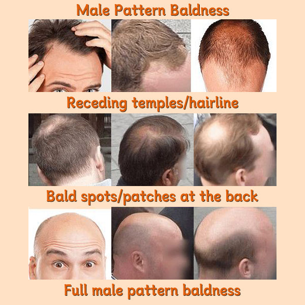 ODALIT™ Root Activator Shampoo - Increased Hair Growth with Just 4 Washes a Week