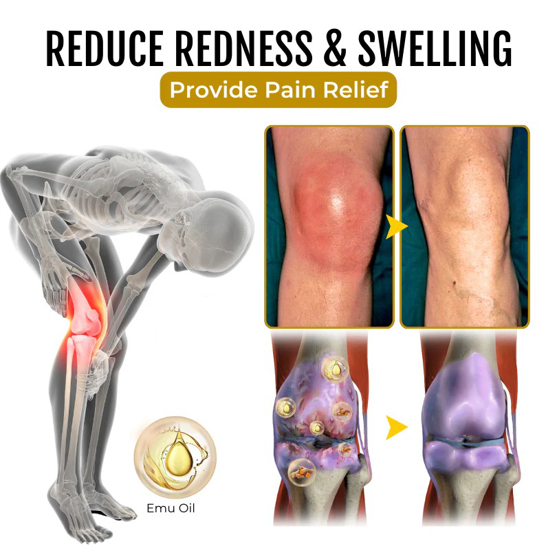 🔥Seurico™ Emu Oil Gel 🧊 Refuse pain and inflammation