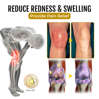 🔥Seurico™ Emu Oil Gel 🧊 Refuse pain and inflammation