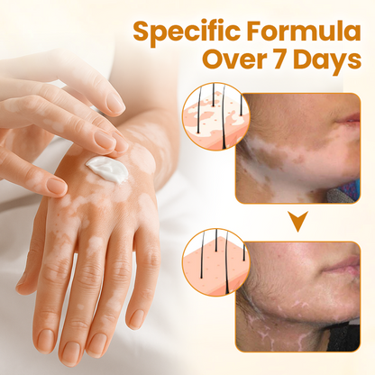 ODEIUN™ VitiClear Pro Bee Venom Cream – Targeted Care for Even-Toned Skin