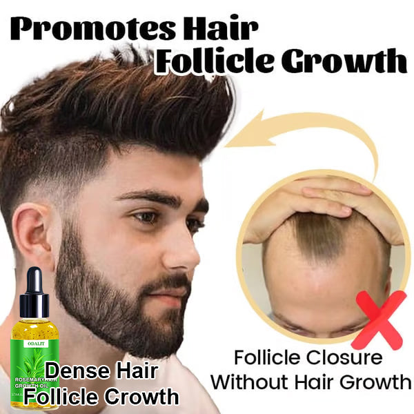 ODALIT™ Hair Growth Serum 🌱(AAD recommended)