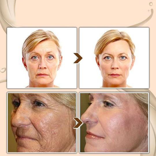 Odeiun™ Turmeric Milk Face Serum - Antioxidant Serum with Sodium Hyaluronate, Niacinamide, and Milk Extract - Anti-Aging & Skin Brightening with Curcuma Longa - 30 ml