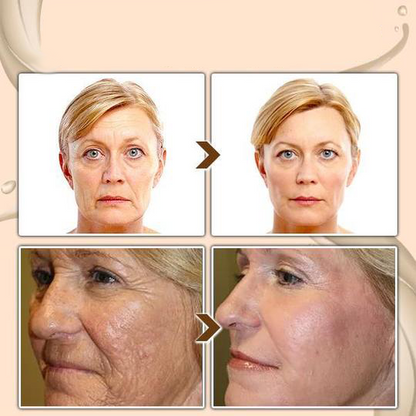 Odeiun™ Turmeric Milk Face Serum - Antioxidant Serum with Sodium Hyaluronate, Niacinamide, and Milk Extract - Anti-Aging & Skin Brightening with Curcuma Longa - 30 ml