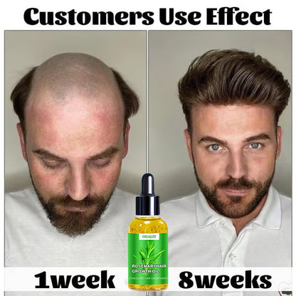 ODALIT™ Hair Growth Serum 🌱(AAD recommended)