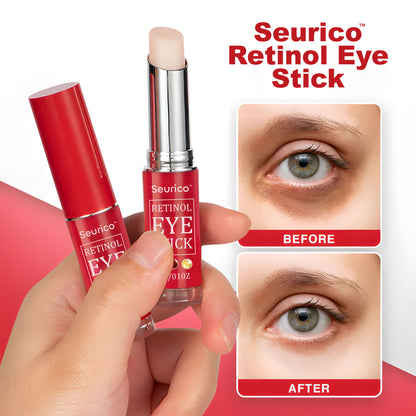 👁️ Seurico™ Retinol Eye Stick – Smooth Away Wrinkles, Puffiness & Dark Circles in Just Weeks!